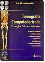 TOMOGRAFIA COMPUTADORIZADA: PRINCIPIOS FISICOS E APLICAÇOES (PRODUTO NOVO)