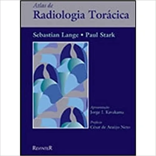 ATLAS DE RADIOLOGIA TORACICA (PRODUTO USADO - MUITO BOM)
