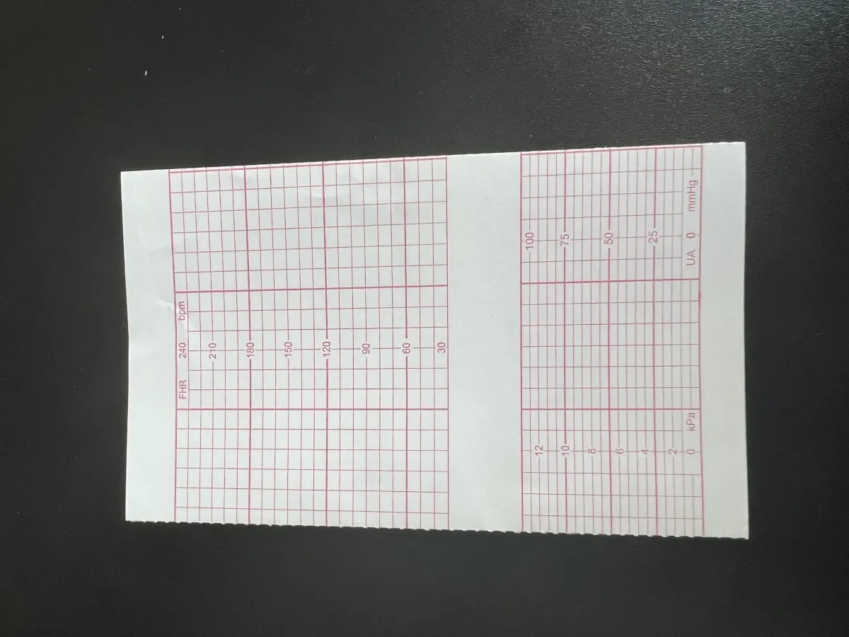 PAPEL TERMOSENSÍVEL P/ CARDIOTOCÓGRAFO EDAN F3/F6/F9 TITS 152X90X160 - pacote com 10 blocos