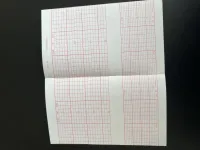 PAPEL TERMOSENSÍVEL P/ CARDIOTOCÓGRAFO EDAN F3/F6/F9 TITS 152X90X160 - pacote com 10 blocos - Foto 2