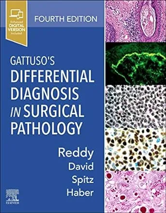 Differential Diagnosis in Surgical Pathology Imagem