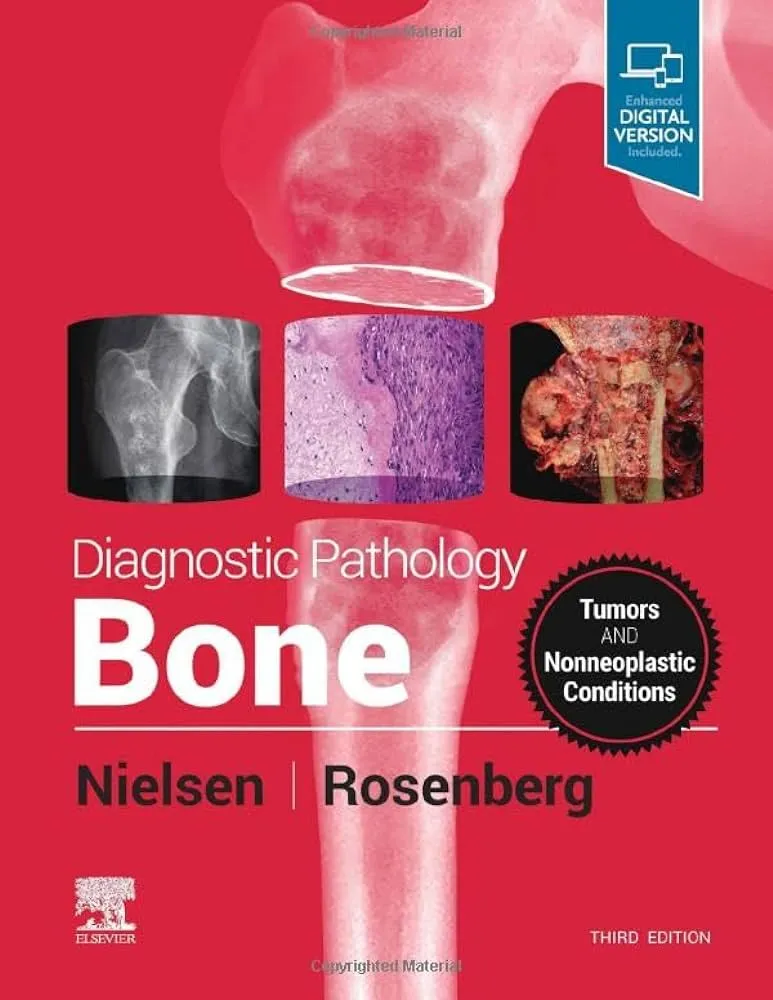Diagnostic Pathology:Bone
