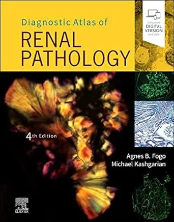Diagnostic Atlas of Renal Pathology Imagem