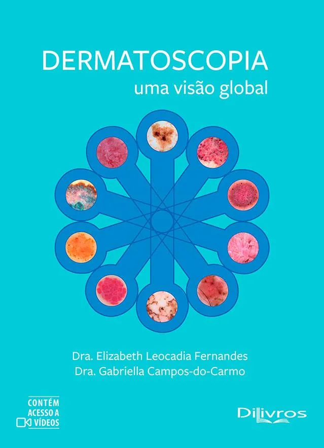  DERMATOSCOPIA UMA VISAO GLOBAL Imagem