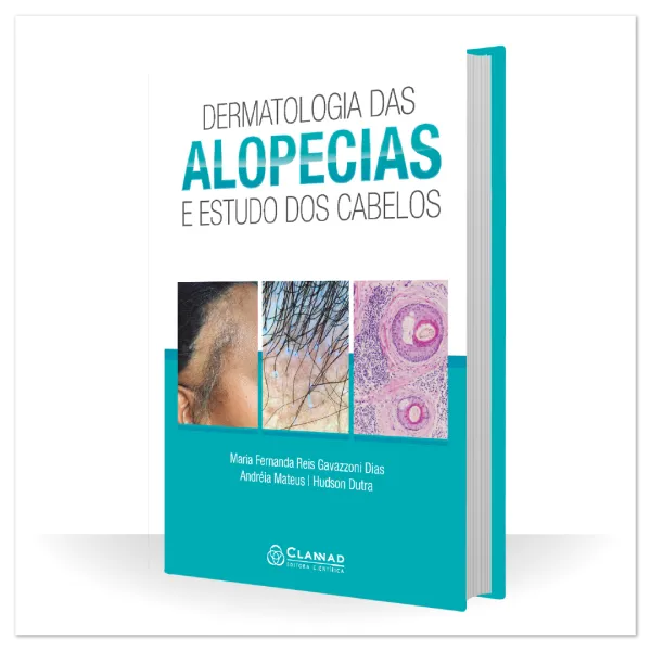 Dermatologia das Alopecias e Estudo dos Cabelos