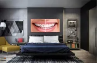 Quadro Decorativo Dentista Aparelho em Tecido Canvas 130x60 - Foto 4