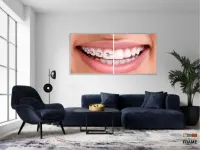 Quadro Decorativo Dentista Aparelho em Tecido Canvas 130x60 - Foto 5