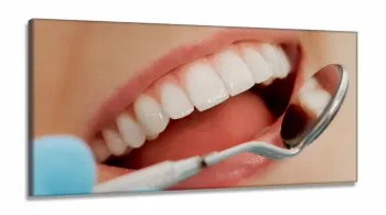 Quadro Em Tecido Odontologia Decorativo Sorriso Espelho em Tecido Canvas 130x60