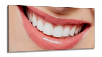Quadro Odontologia Decorativo Consultório Sorriso em Tecido Canvas 130x60