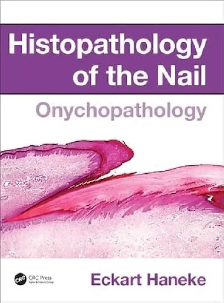 Histopathology of the Nail: Onychopathology Imagem