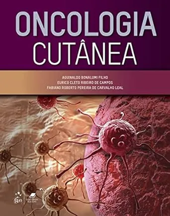 Oncologia Cutanea - 1a Edição