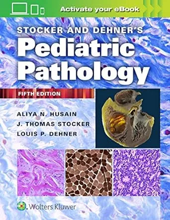 Stocker and Dehner's Pediatric Pathology Imagem