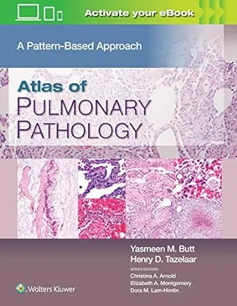 Atlas of Pulmonary Pathology Imagem