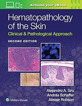 Hematopathology of the Skin   Imagem