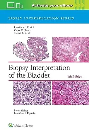 Biopsy Interpretation of the Bladder Imagem