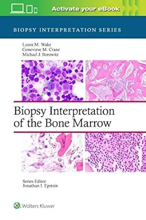 Biopsy Interpretation of the Bone Marrow Imagem