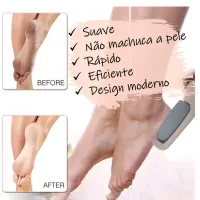 Lixa Esfoliadora Profissinal Elétrica Recarregável Beauty - Foto 4