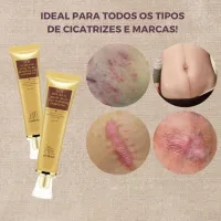 Creme Removedor de Cicatriz e Clareador de Manchas na Pele Lanbena - 30g - Foto 6
