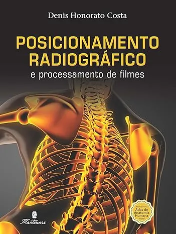 POSICIONAMENTO RADIOGRAFICO E PROCESSAMENTO DE FILMES (PRODUTO USADO - MUITO BOM)