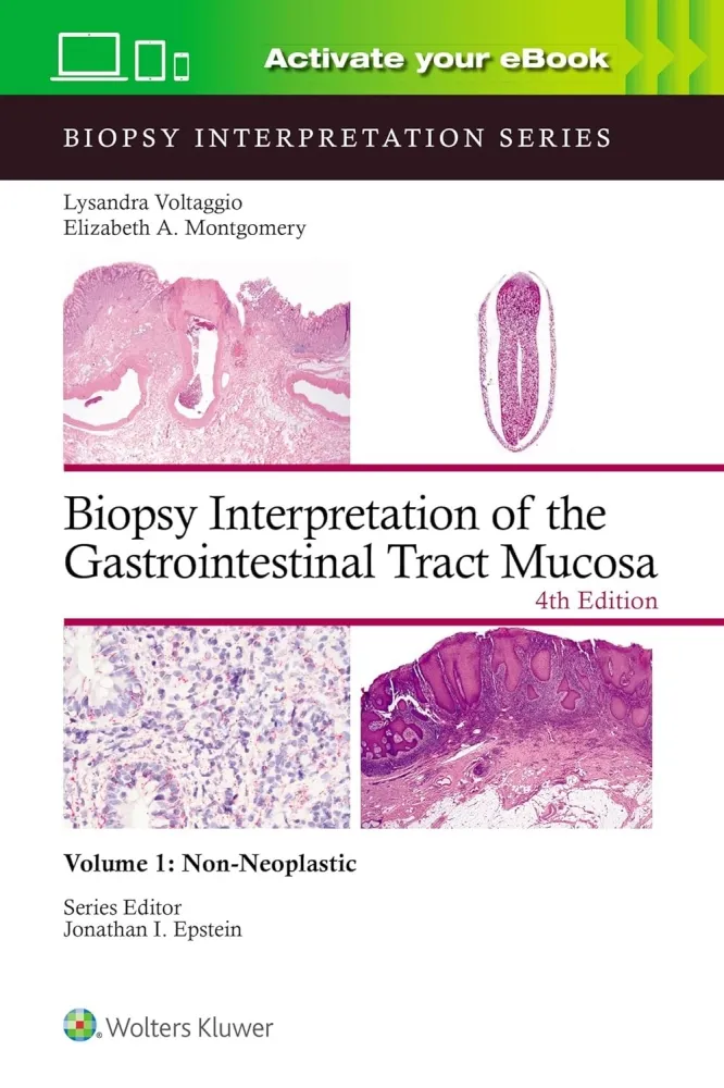 Biopsy Interpretation of the Gastrointestinal Tract Mucosa: Non-Neoplastic - Volume 1 (Print + eBook with Multimedia)