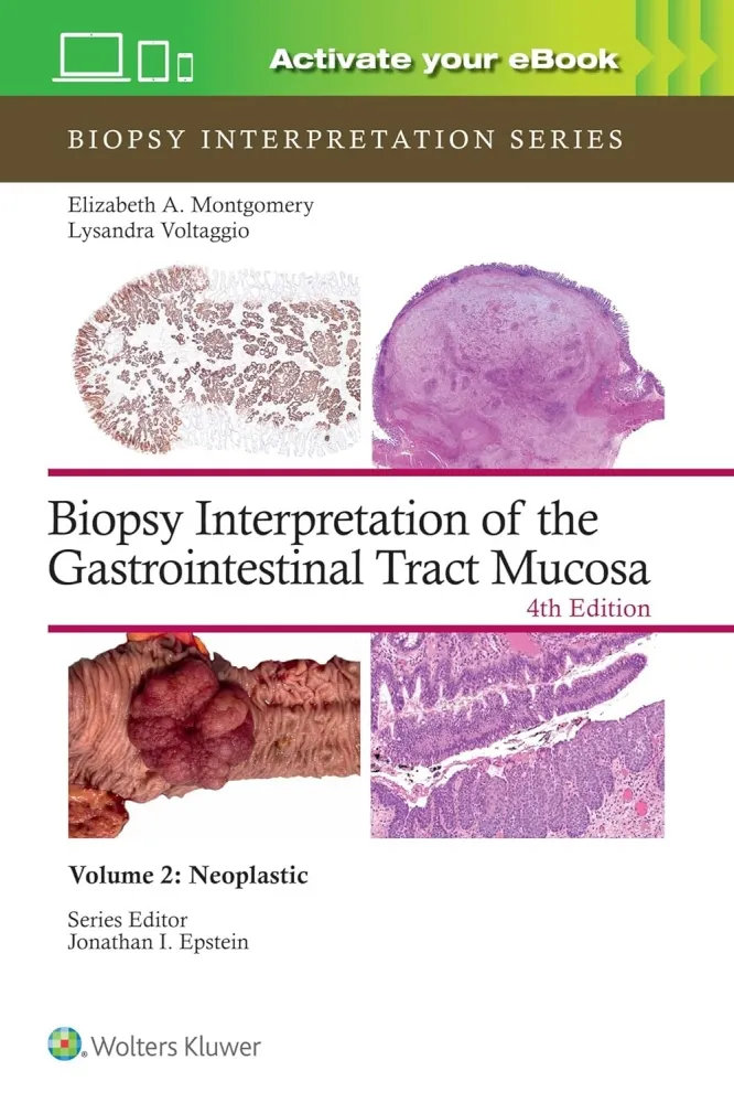 Biopsy Interpretation of the Gastrointestinal Tract Mucosa: Neoplastic -  Volume 2 (Print + eBook with Multimedia)