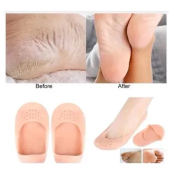 Meia Silicone Hidratante Pé Calcanhar Antiderrapante Aumento pes Protetor Silicone Pe Sapato Par de Meia Palmilha - Foto 2