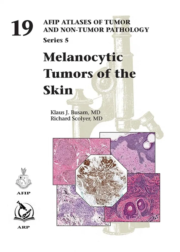 Melanocytic Tumors of the Skin: (5F19)