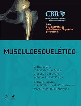 CBR - MUSCULOESQUELETICO (PRODUTO USADO - MUITO BOM)
